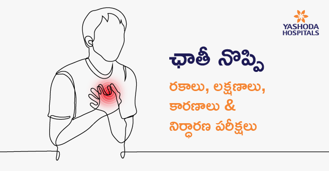 Chest pain types Main