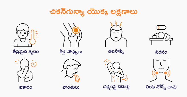 Chicken Gunya Symptoms