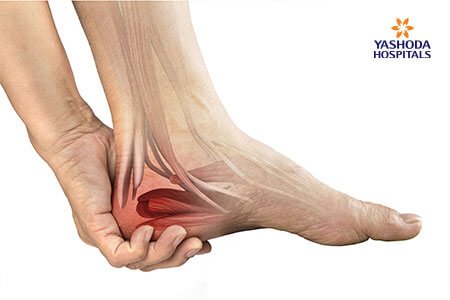 Heel Pain