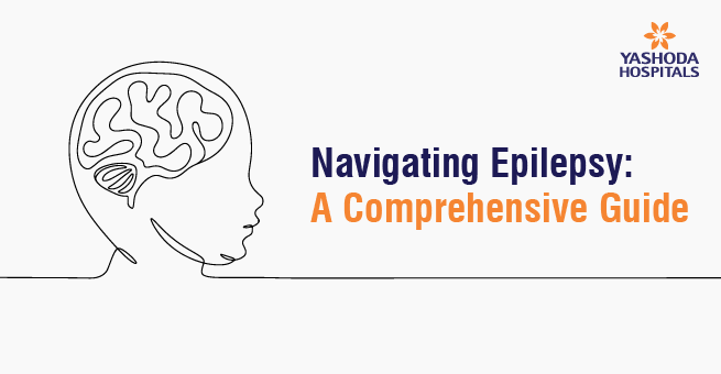 Navigating Epilepsy: A Comprehensive Guide