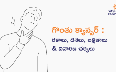 గొంతు క్యాన్సర్ : రకాలు, దశలు, లక్షణాలు & నివారణ చర్యలు