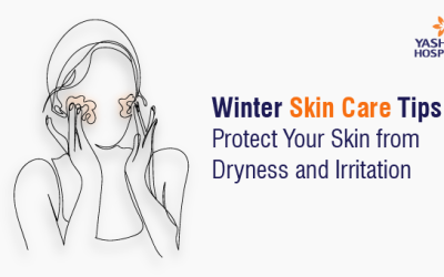 Winter Skin Care Tips: Protect Your Skin from Dryness and Irritation