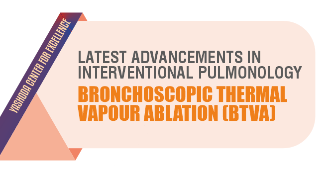 Latest Advancements in Interventional Pulmonology Bronchoscopic Thermal Vapour Ablation (BTVA)