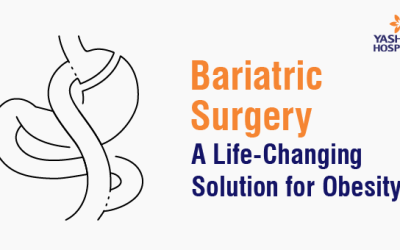 Bariatric Surgery: A Life-Changing Solution for Obesity