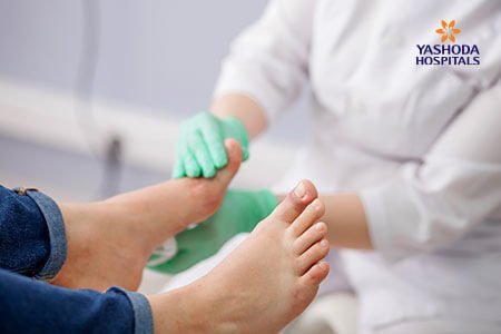 Diabetic Charcot Foot prevented