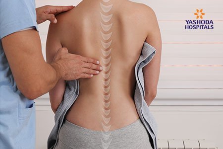 Kyphosis of the Spine diagnosed