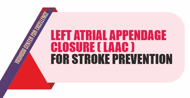 Left Atrial Appendage Closure (LAAC) For Stroke Prevention