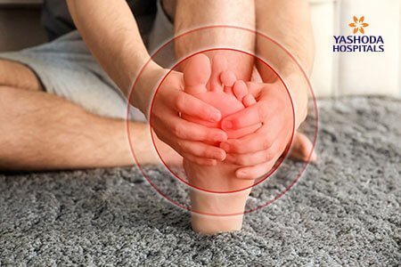  the symptoms of Morton’s Neuroma