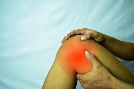 Patellofemoral Arthritis