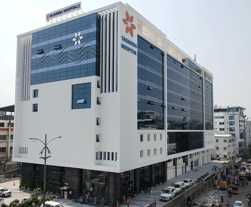 Yashoda Hospitals Secunderabad