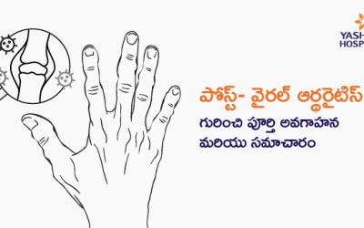 పోస్ట్- వైరల్ ఆర్థరైటిస్ గురించి పూర్తి అవగాహన మరియు సమాచారం