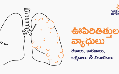 ఊపిరితిత్తుల (లంగ్స్) వ్యాధులు: రకాలు, కారణాలు, లక్షణాలు & నివారణలు