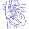 Patent Ductus Arteriosus (PDA)