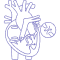 Ventricular Septal Defect