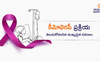 కీమోథెరపీ ప్రక్రియ: తెలుసుకోవలసిన ముఖ్యమైన వివరాలు
