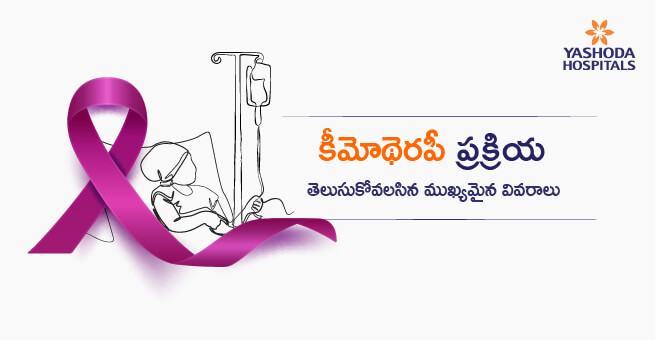 కీమోథెరపీ ప్రక్రియ: తెలుసుకోవలసిన ముఖ్యమైన వివరాలు