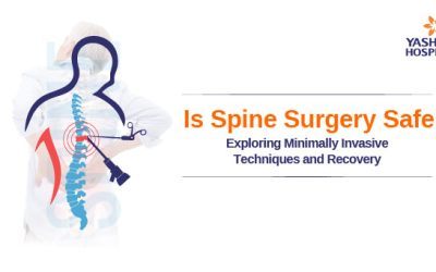 Is Spine Surgery Safe? Exploring Minimally Invasive Techniques and Recovery