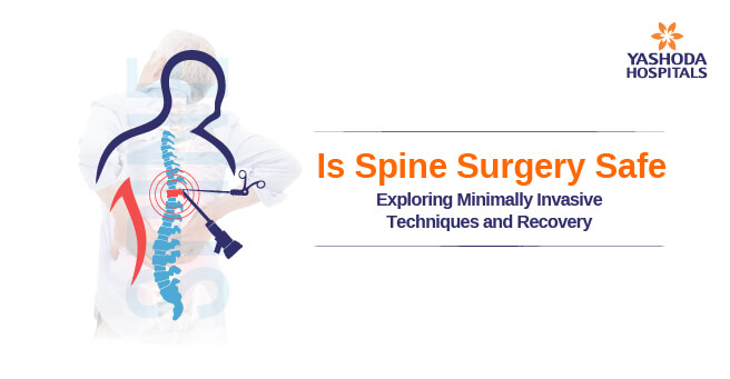 spine surgery main banner