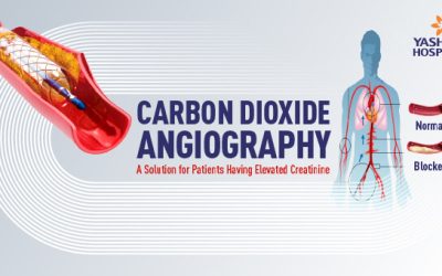 Carbon Dioxide Angiography: A Solution for Patients Having Elevated Creatinine