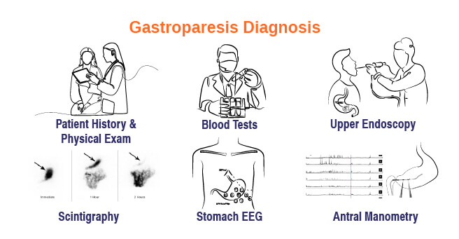 Gastroparesis Diagnosis