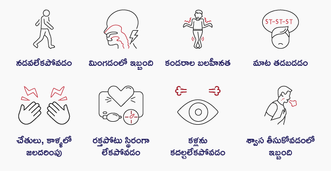 Guillain-Barre Syndrome_symptoms