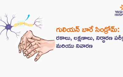 గులియన్ బారే సిండ్రోమ్: రకాలు, లక్షణాలు, నిర్ధారణ పరీక్షలు మరియు నివారణ