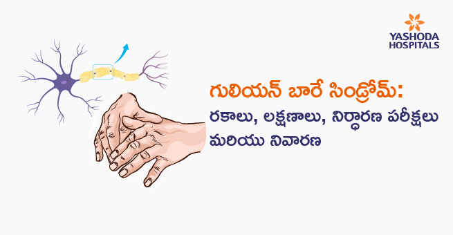 Guillain-Barre Syndrome_Main_banner