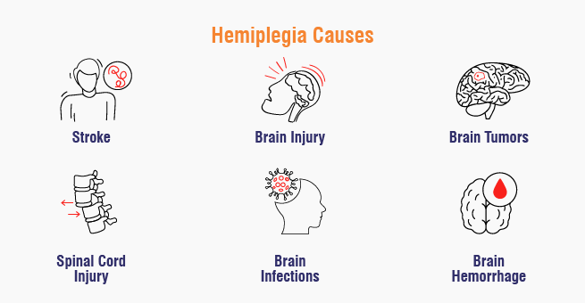 Hemiplegia causes