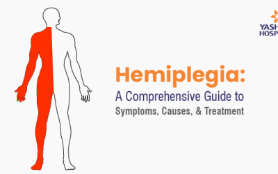 Hemiplegia: A Comprehensive Guide to Symptoms, Causes, & Treatment