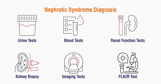 Nephrotic Syndrome Diagnosis