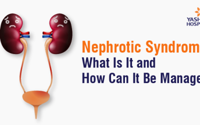 Nephrotic Syndrome: What Is It and How Can It Be Managed?