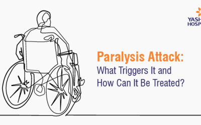 Paralysis Attack: What Triggers It and How Can It Be Treated?