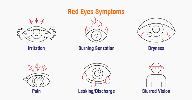 Red Eyes Symptoms