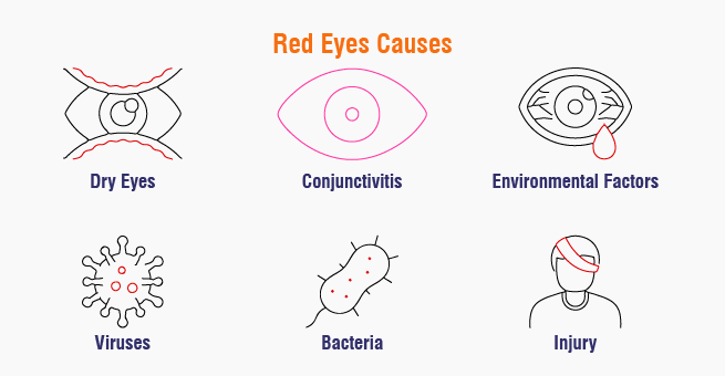 Red Eyes Causes