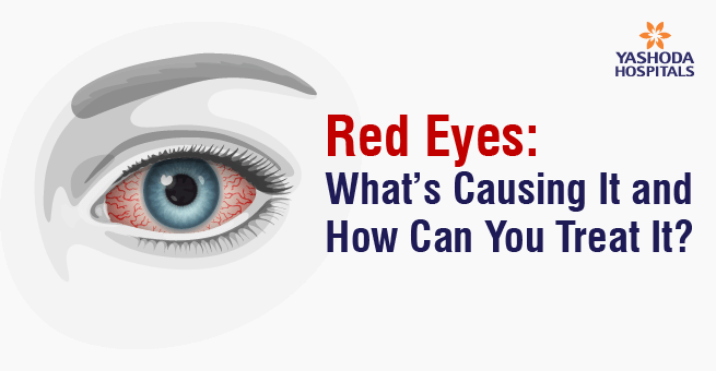 Red Eyes Main Banner