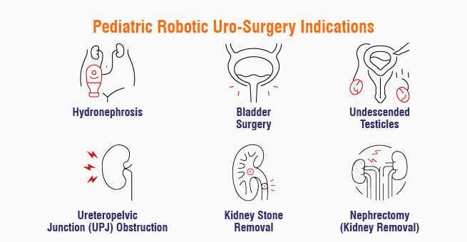 Robotic Surgery for Kids Advancements in Pediatric Urology