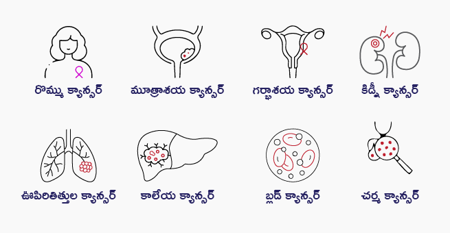 Types of Gastrointestinal Cancer & Role and Benefits of Immunotherapy in Cancer Treatments_Body