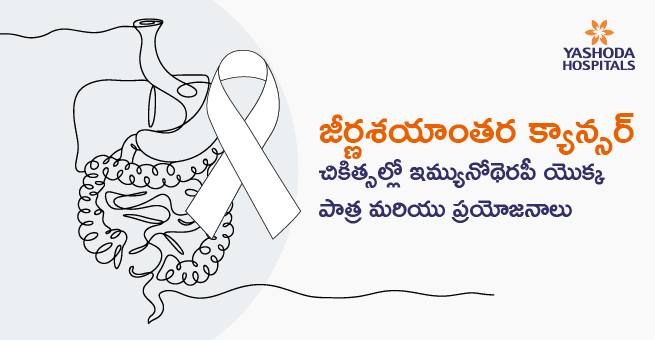 జీర్ణశయాంతర క్యాన్సర్ చికిత్సల్లో ఇమ్యునోథెరపీ యొక్క పాత్ర మరియు ప్రయోజనాలు