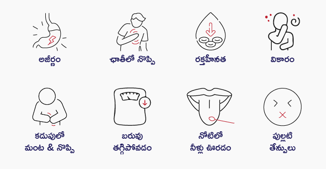 Ulcers Types, Signs, Symptoms, Causes & Treatment