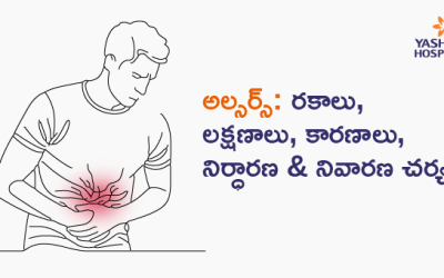 అల్సర్స్: రకాలు, లక్షణాలు, కారణాలు, నిర్ధారణ & నివారణ చర్యలు