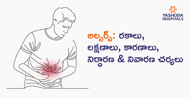 Ulcers Types, Signs, Symptoms, Causes & Treatment Main Telugu Banner