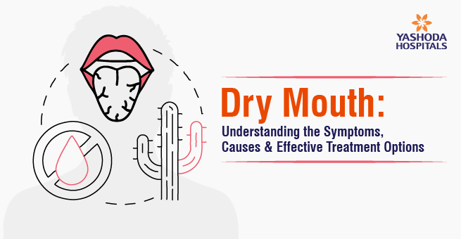 Dry Mouth Understanding the Symptoms Main Banner