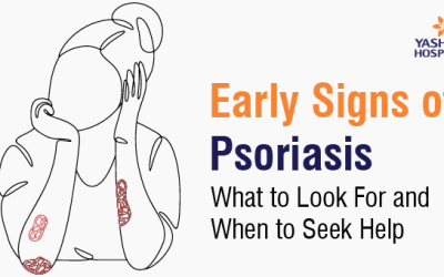 Early Signs of Psoriasis: What to Look For and When to Seek Help