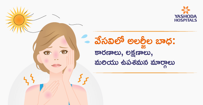Summer allergies Main Banner Telugu