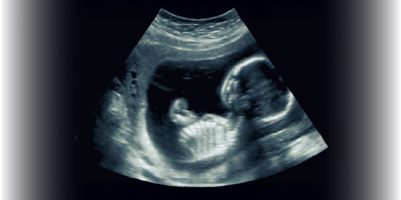 Web Banner_Fetal MRI