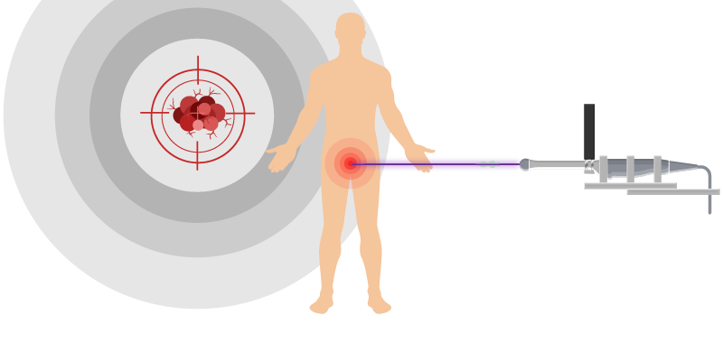 Web Banner_High-Dose Rate-HDR Brachytherapy-06