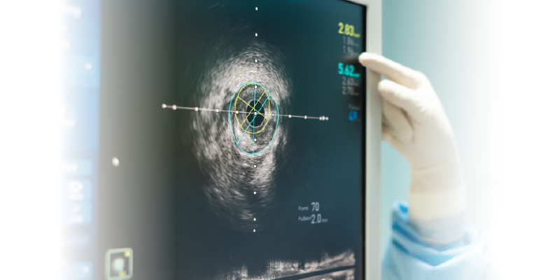 Web Banner_Intravascular ultrasound
