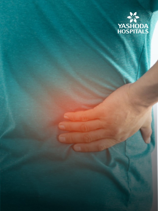 kidney stone slide 7