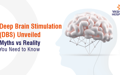 Deep Brain Stimulation (DBS) Unveiled: Myths vs. Reality You Need to Know