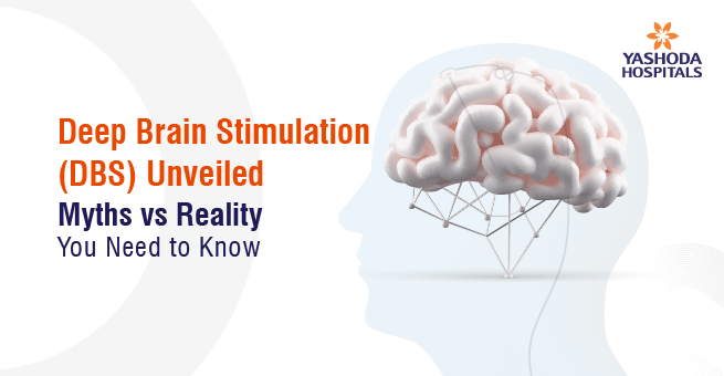 Deep Brain Stimulation (DBS) Main Banner